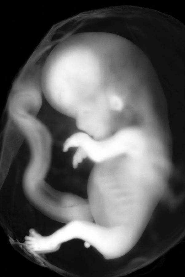An embryo at the 9-10 week stage.

Courtesy of Creative Commons