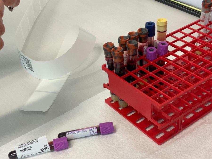 Blood samples on a lab bench.